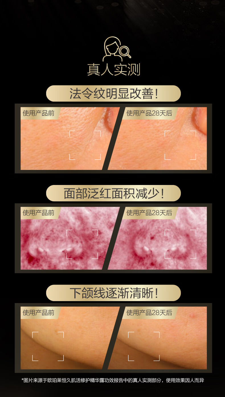 欧珀莱（AUPRES）【唐嫣同款】恒久精华  礼物送女友送老婆 恒久修护肌底精华露60ml 25年1月