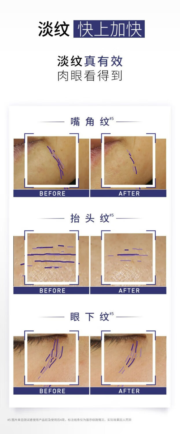 欧莱雅紫熨斗眼霜女二代淡纹玻尿酸黑眼圈眼袋细纹提拉紧致护肤品礼物女 2代紫熨斗眼霜7.5ml*8支（共60ml