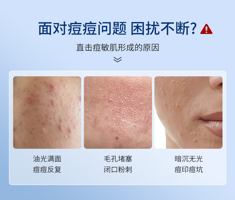 可忆美蝾螈肽祛痘精华液护肤品提亮淡纹配送样品套装保湿修护痘印祛痘坑 【随机发】2支体验装5ml