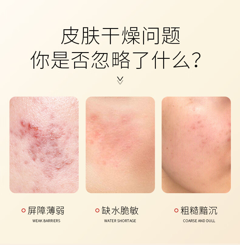 欧诺兰护肤品套装礼盒胶原蛋白玻尿酸精华面霜乳嫩肤补水保湿礼盒 套装礼盒1盒