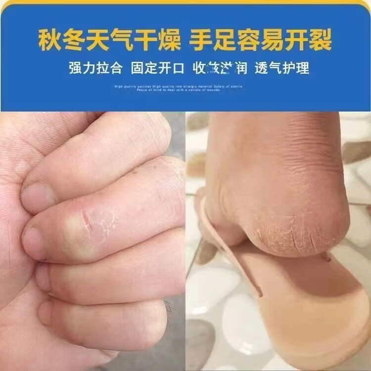 菲脂秋冬手脚干美妆工具胶布手足手指皲裂透气高粘度耐磨脚后跟裂口 干裂贴 100贴