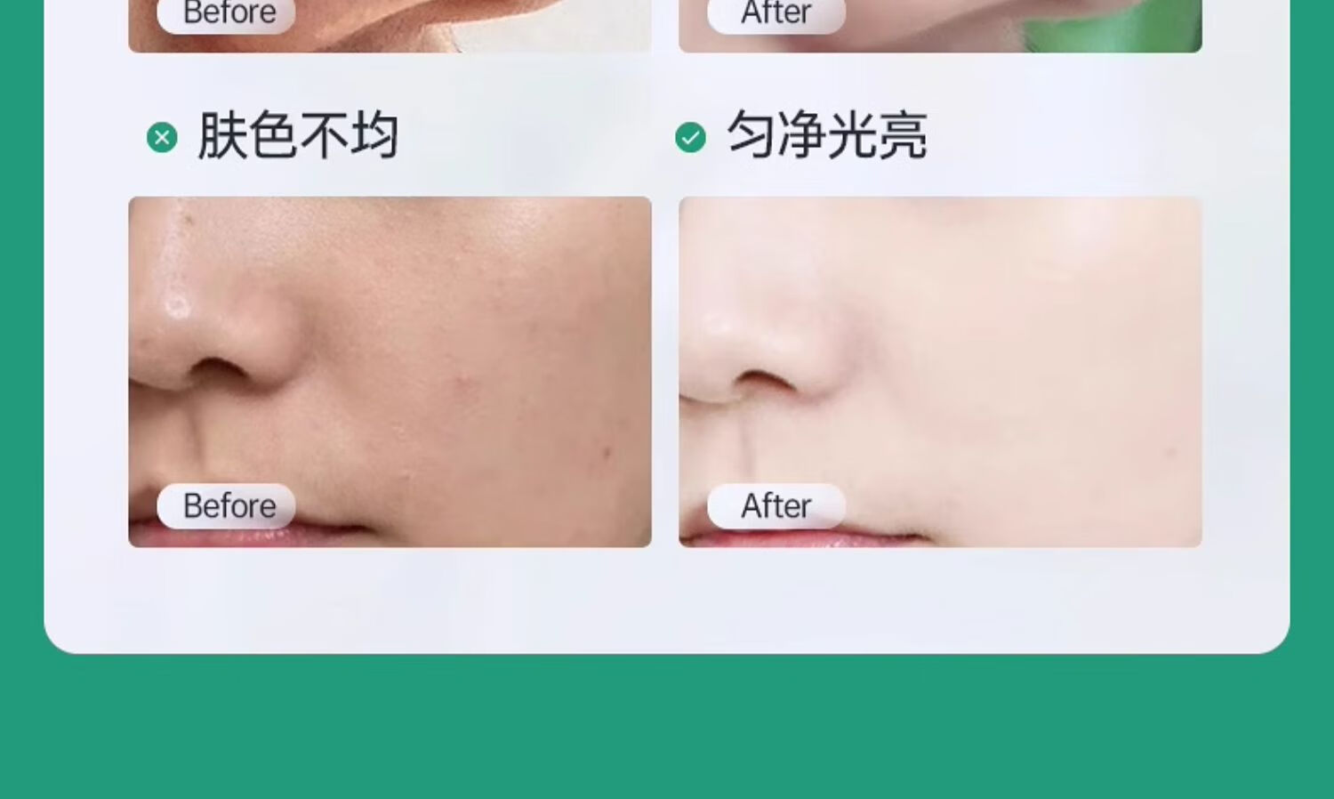 BIGLY水杨酸面膜控油淡化痘印去黑头闭口粉刺深层清洁收缩毛孔涂抹面膜 水杨酸面膜150g一瓶装
