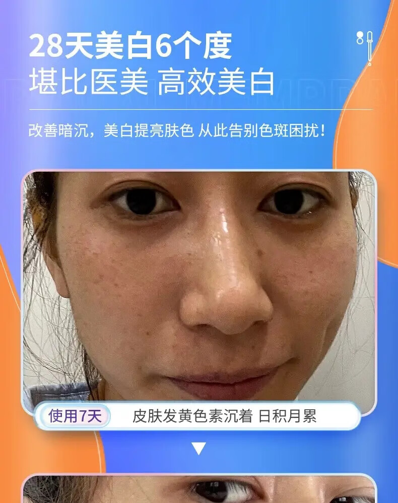 韩鹭美白祛斑霜淡化黑色素去雀斑黄褐斑老年斑晒斑妊娠斑男女可用 一瓶50g【体验装】