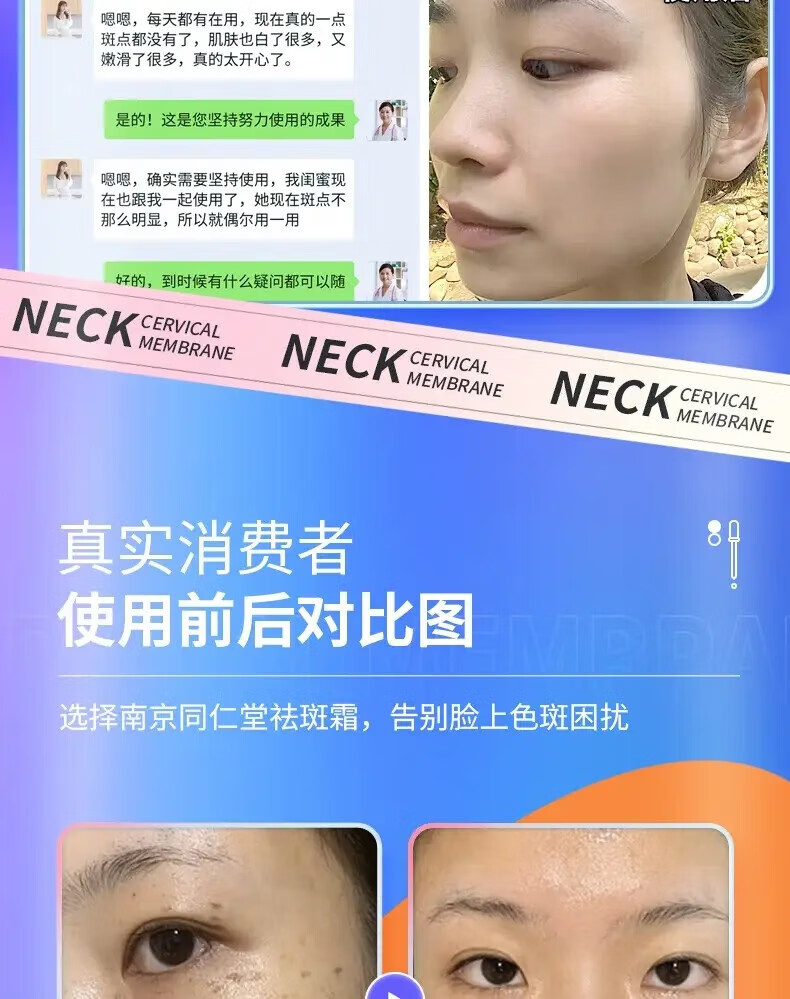 韩鹭美白祛斑霜淡化黑色素去雀斑黄褐斑老年斑晒斑妊娠斑男女可用 一瓶50g【体验装】