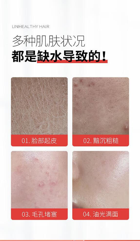 白云山烟酰胺马来西亚甘油液提亮肤色改善暗沉补水保湿滋润精华液 4瓶装【滋润 补水 买2 送2】