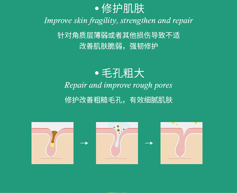 BIGLY水杨酸面膜控油淡化痘印去黑头闭口粉刺深层清洁收缩毛孔涂抹面膜 水杨酸面膜150g一瓶装
