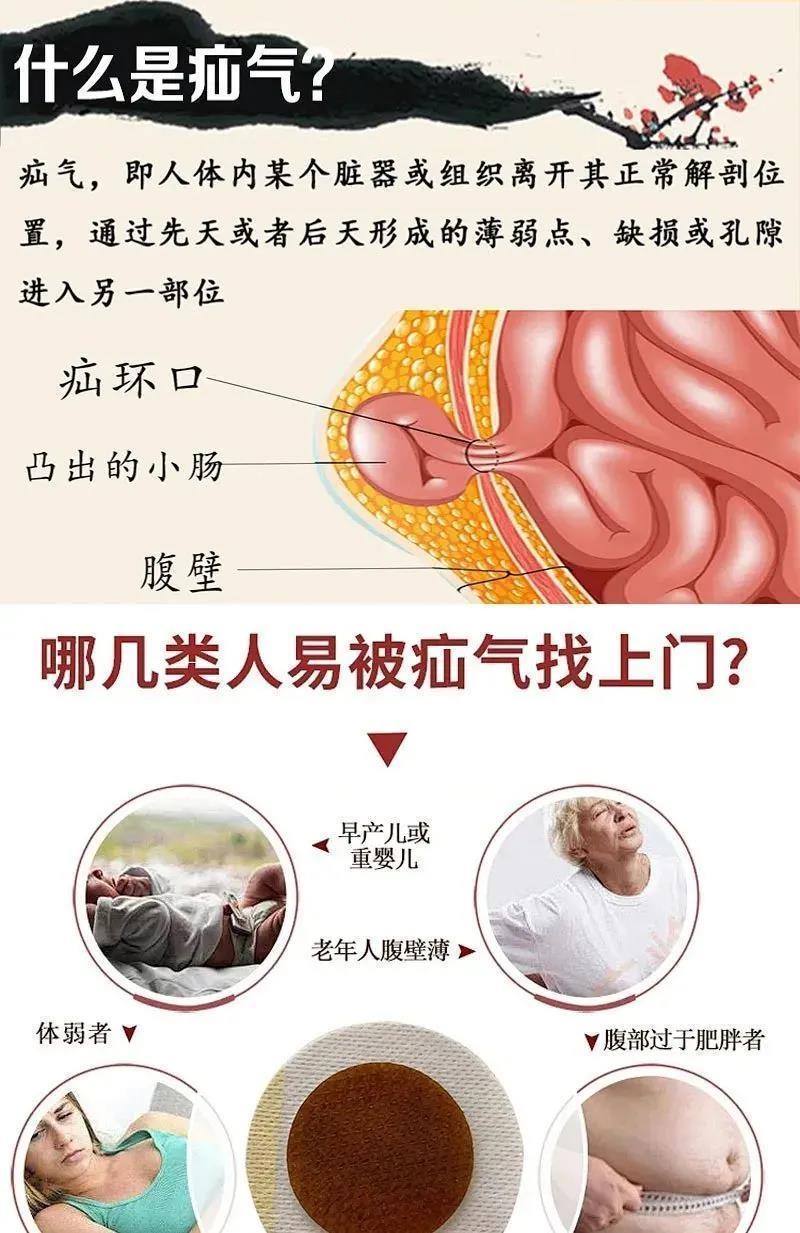 疝气贴成人消贴脐疝斜疝腹股沟疝肚脐贴冷敷贴小儿老人疝气专用贴