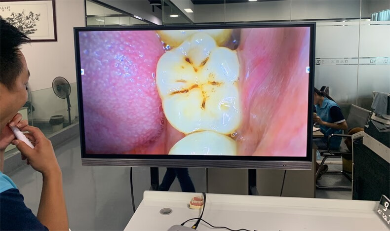 usb口腔内窥镜牙科便携式移动无线手柄电脑手机平板ipad电视机屏 有线