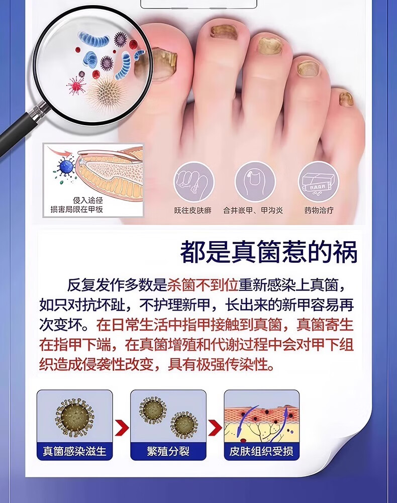 Mattetong Gray Toenail Phototherapy Lamp Smart Gray Toenail Laser Fungus Treatment Device Foot Nail Sterilization Lamp 9