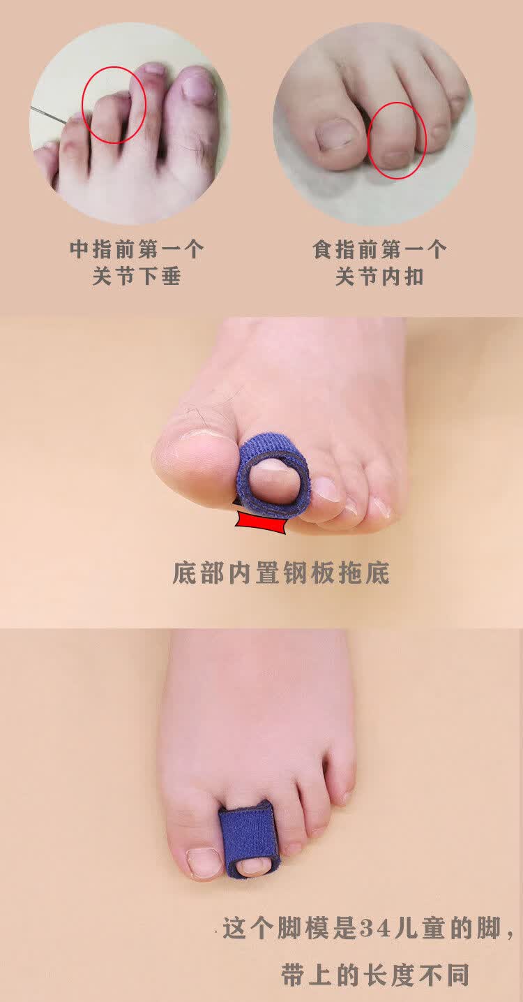 脚趾前关节下垂弓起内扣固定锤头趾康复弯曲重叠食指可走路sn3292 s号