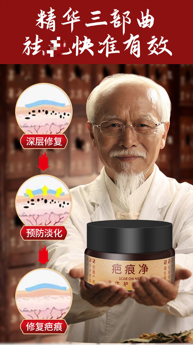 疤痕疙瘩胸前 疤痕净护理软膏【图片 价格 品牌 报价】-京东