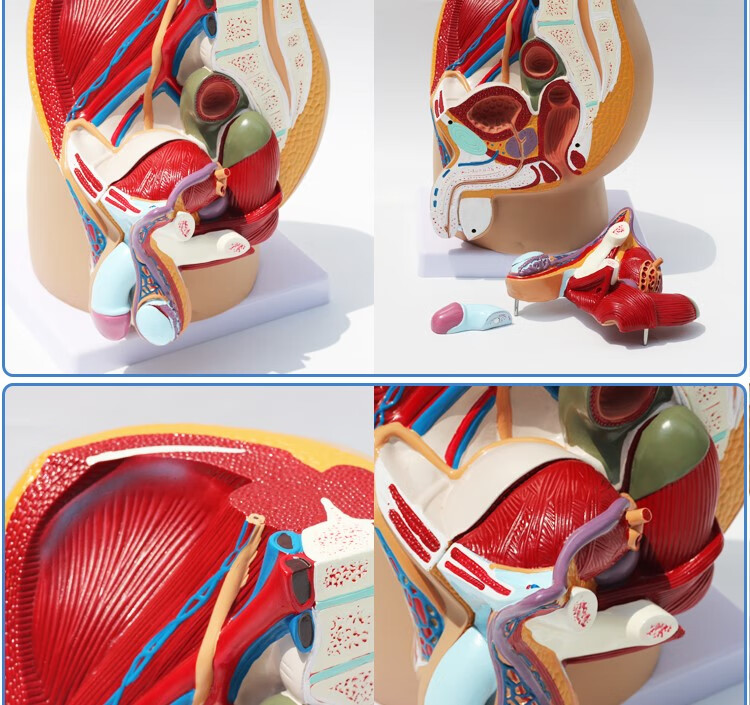 【藥房直售】男性矢狀解剖(4件)男性盆腔矢狀解剖模型 男性生殖器解剖