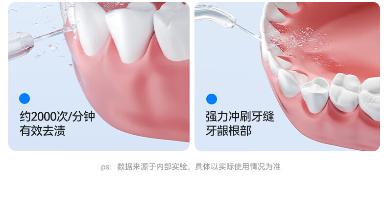 KONKA Oral Irrigator Home Dental Cleaner Teeth Washer Water Flosser Portable Upright Orthodontic Anti-Tartar Adult Couples Birthday Gift 41