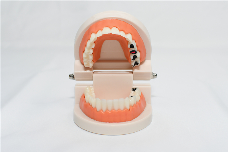 儿童牙齿模型早教刷牙幼儿小孩认知假牙口腔牙齿模型幼儿园教学模型