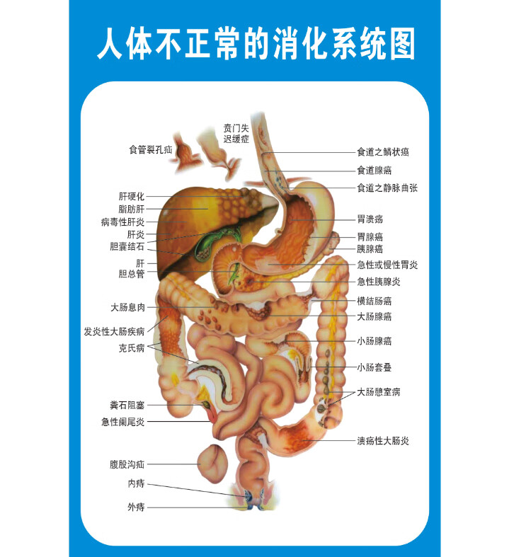 人体内脏解剖系统示意图医学宣传挂图人体器官心脏结构图医院海报人体