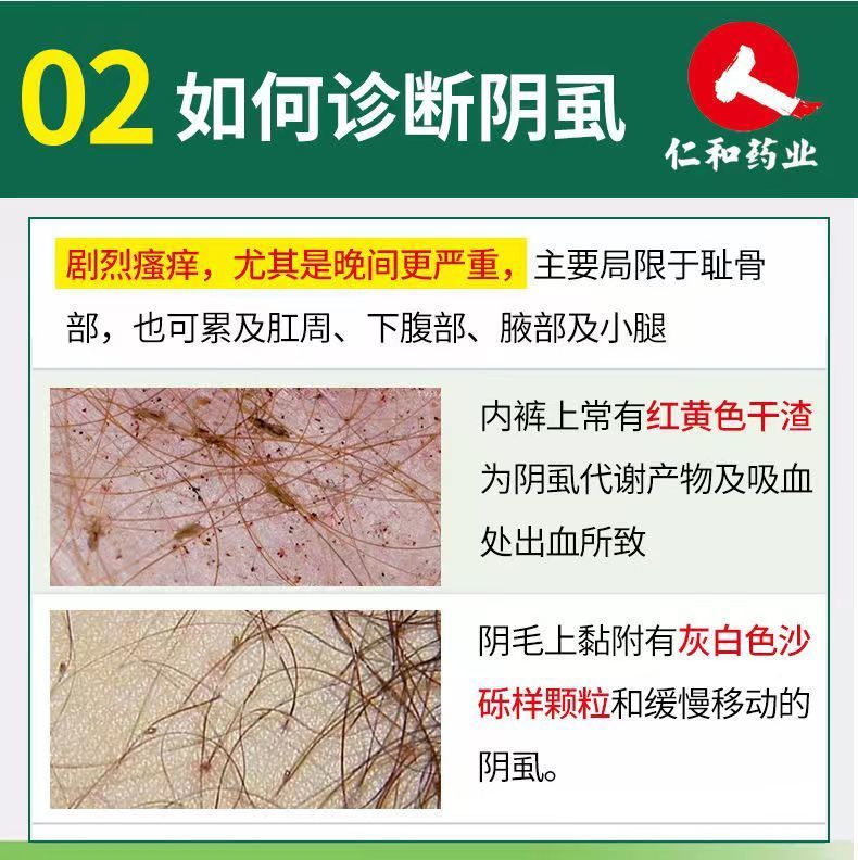 虱子药百部酊喷剂虱立净瘙痒阴虱头虱体虱卵私处儿童头虱虮子泰斯3瓶