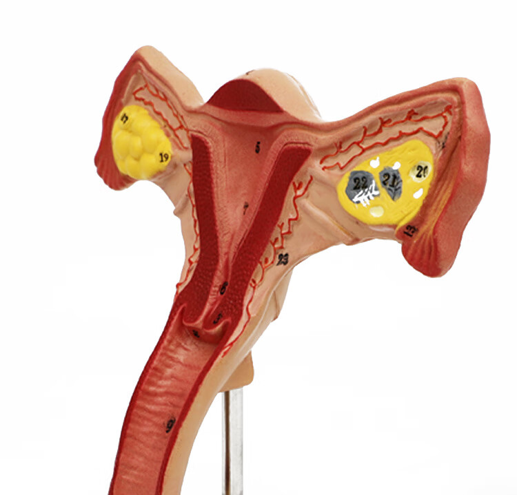 wecan人體女性生殖子宮解剖病理模型 卵巢教學模型婦科教學用具 卵巢