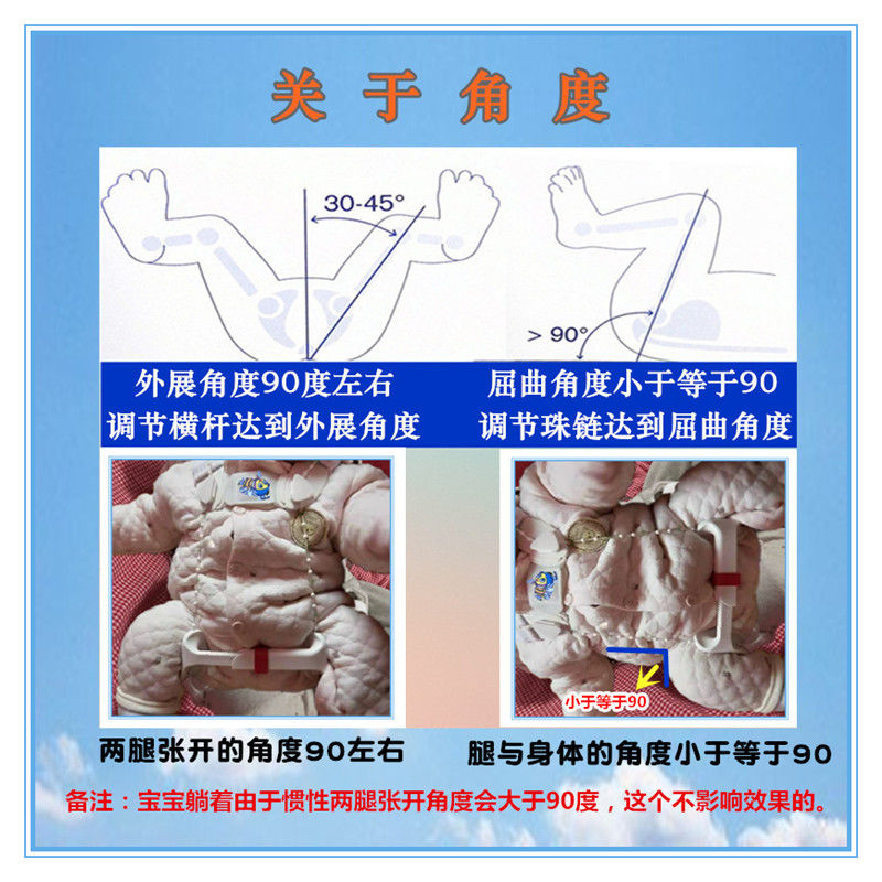 京健康婴儿吊带式髋关节外展支具儿童蛙式支架髋关节发育不良脱位矫形