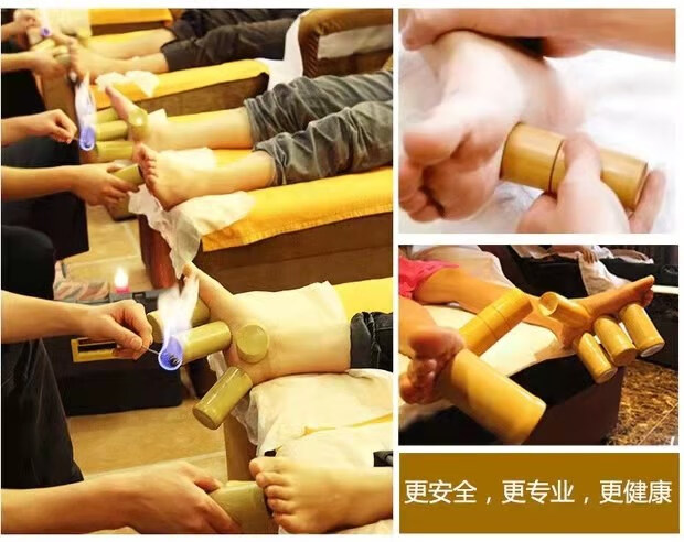 足底竹罐拔火罐竹吸筒碳化罐木罐拔罐器脚底套装家用医院足疗男士足底