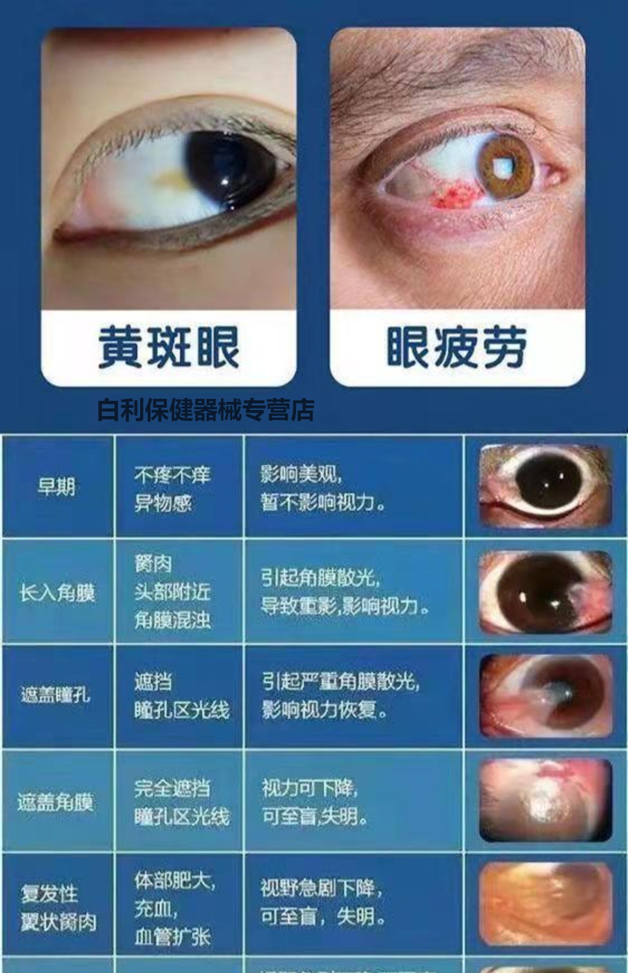 眼睛息肉照片图片