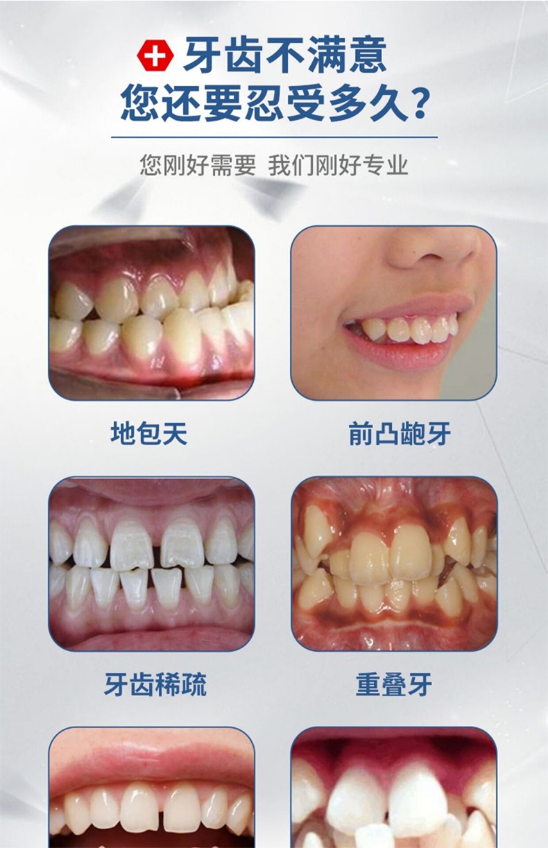 仁和 牙齿矫正器可搭隐形牙套定位器矫正龅牙地包天不整齐适用防磨