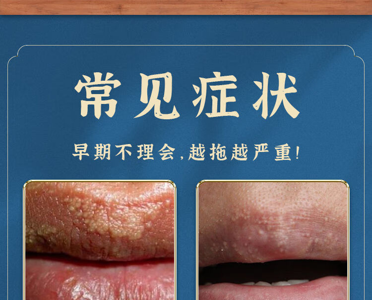 真菌星皮脂腺异位嘴唇干裂起泡长白斑丘了疹疙瘩润唇膏唇部长脂肪粒