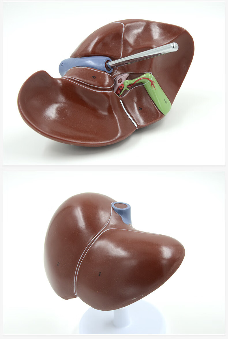 肝脏模型肝胆胰脾解剖 器官模型教学展示礼品医药人体内脏教具【图片