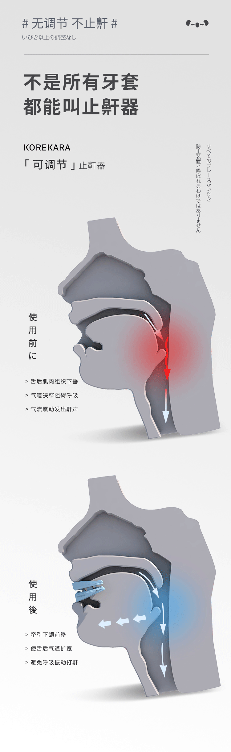 日本止鼾牙套神器止鼾器防止打鼾打呼噜消口腔矫治器矫正器深蓝色