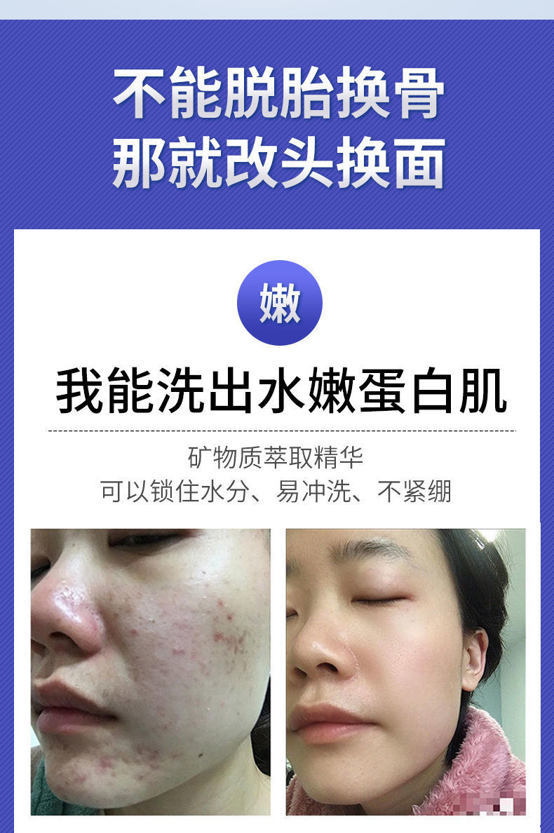 华南理工大学研发洗面奶韩鹭洗面奶水杨酸控油去豆洗面奶华南理工大学