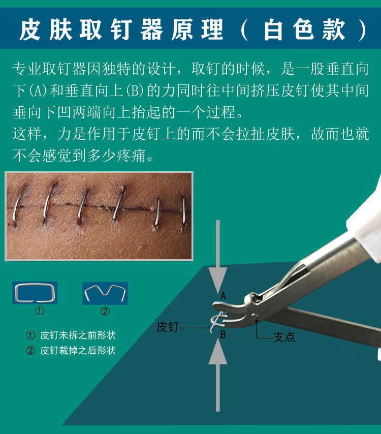 骨折开颅缝合针外科手术后伤口拆钉器专用皮肤取钉器起钉器 包皮拆针