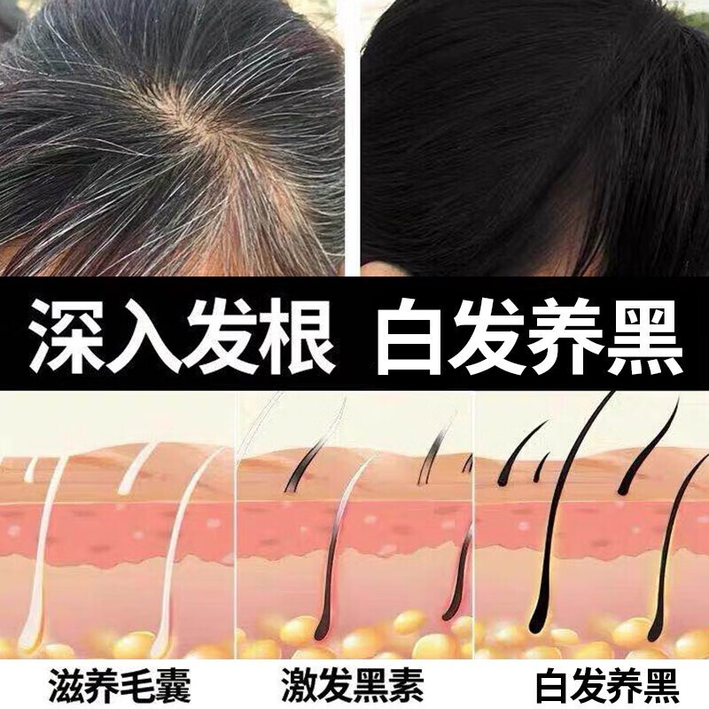 韩鹭何首乌滋养洗发水去屑止痒中药固发白变黑洗发液男女士防掉发五