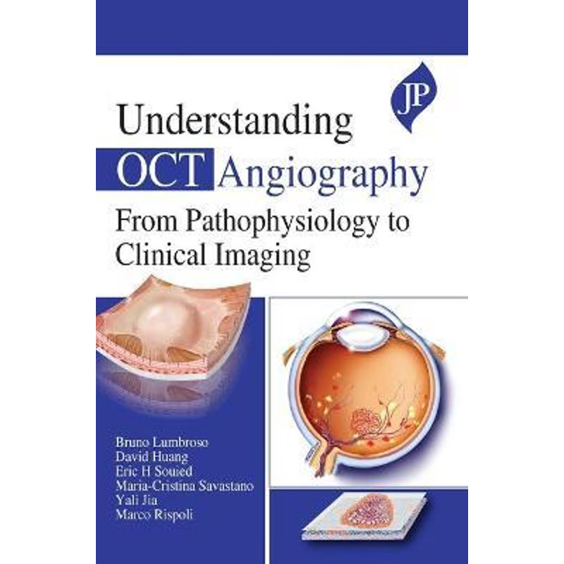 按需印刷UNDERSTANDING OCT ANGIOGRAPHY FROM PATHOPHYSIOLOGY TO CLINICAL IMAGING[9781909836938]