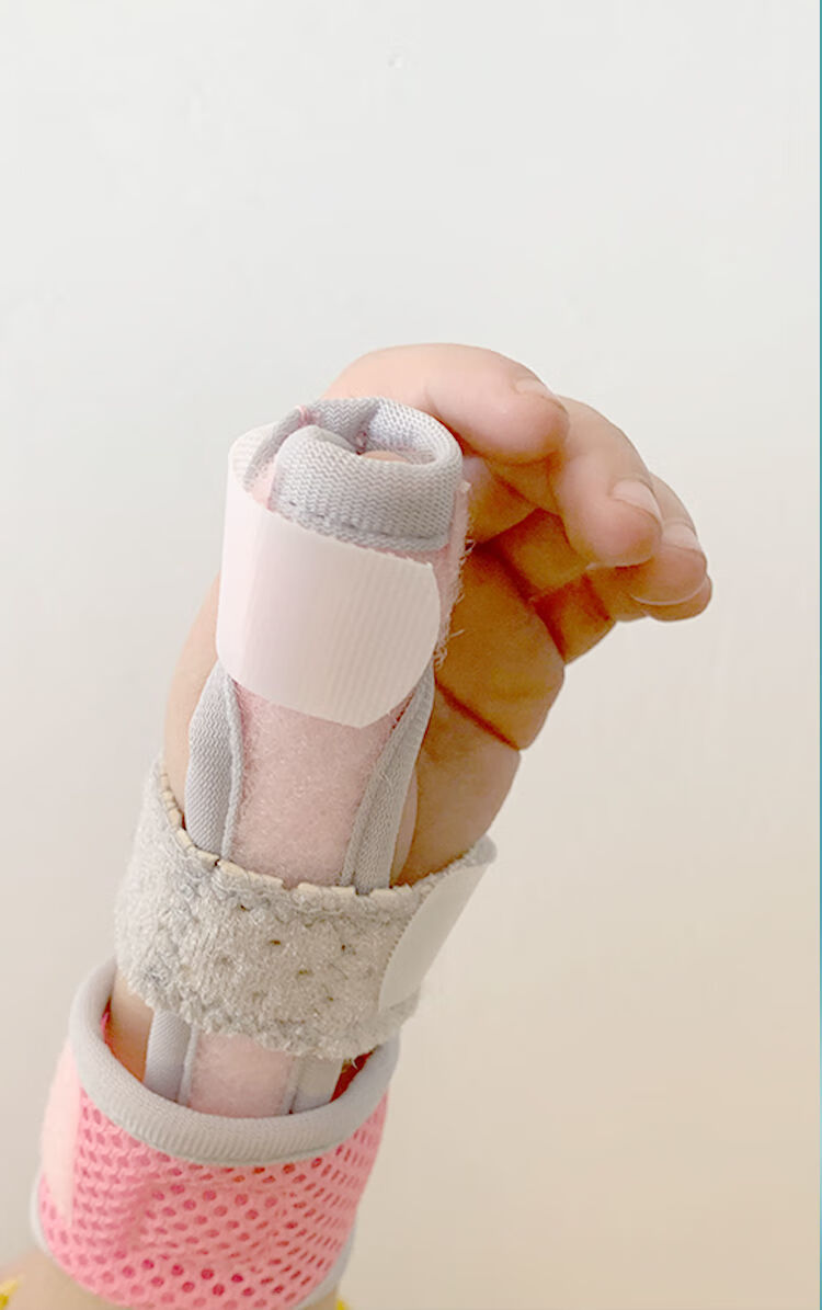 婴儿儿童手指固定夹板掌骨肌腱拉伤扭伤腱鞘手部康复支具 粉色【双指
