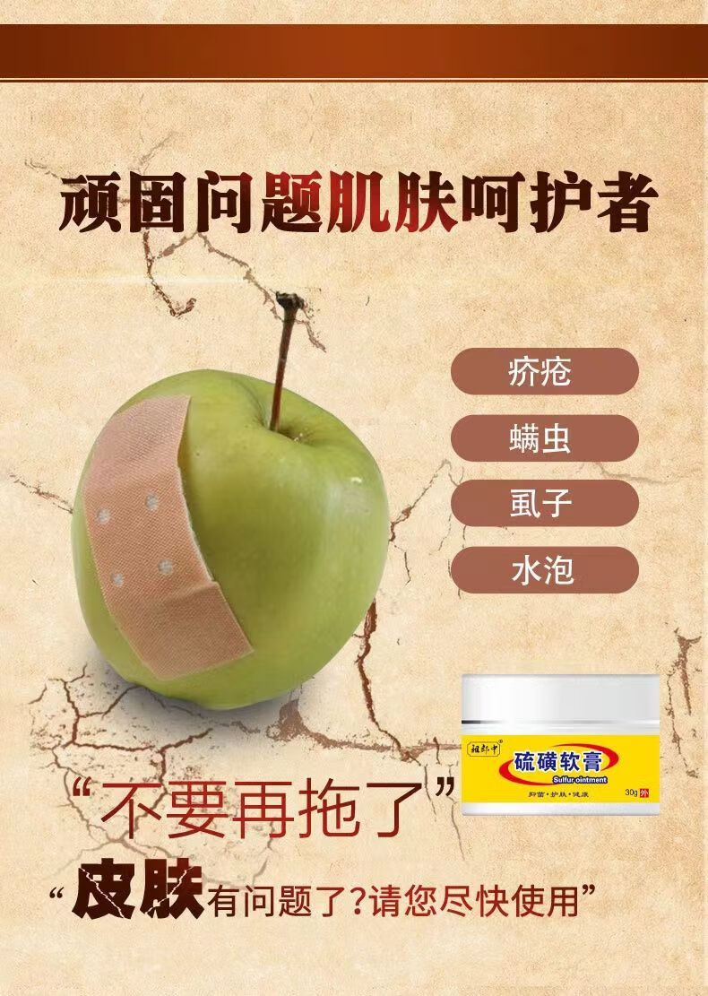【京东大药房直发】祖郎中硫磺软膏20%含量硫磺乳膏30克抑菌止痒皮肤