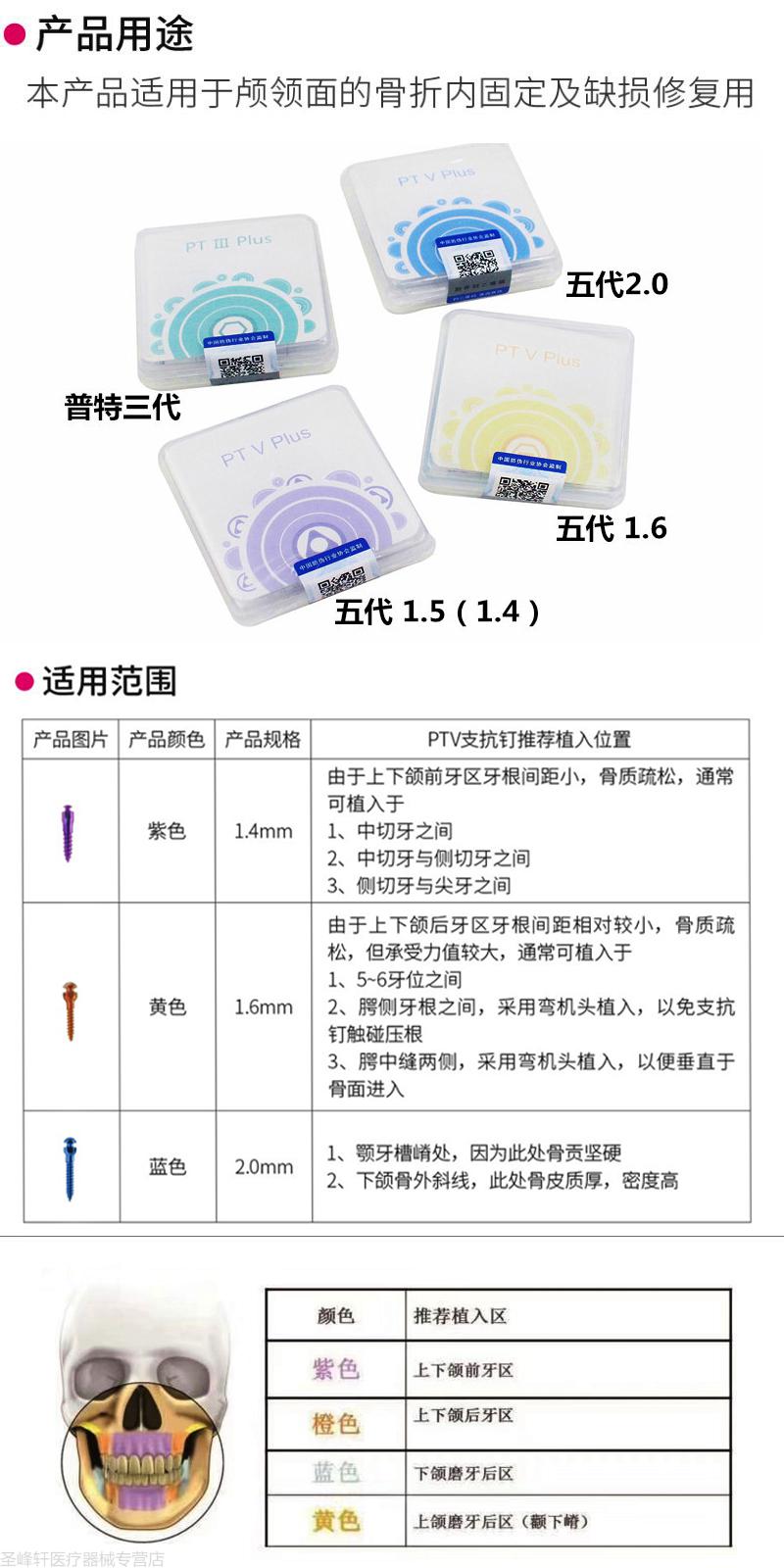 牙科材料支抗钉普特三代五代彩色支抗钉齿科口腔种植工具 五代 1.6*10