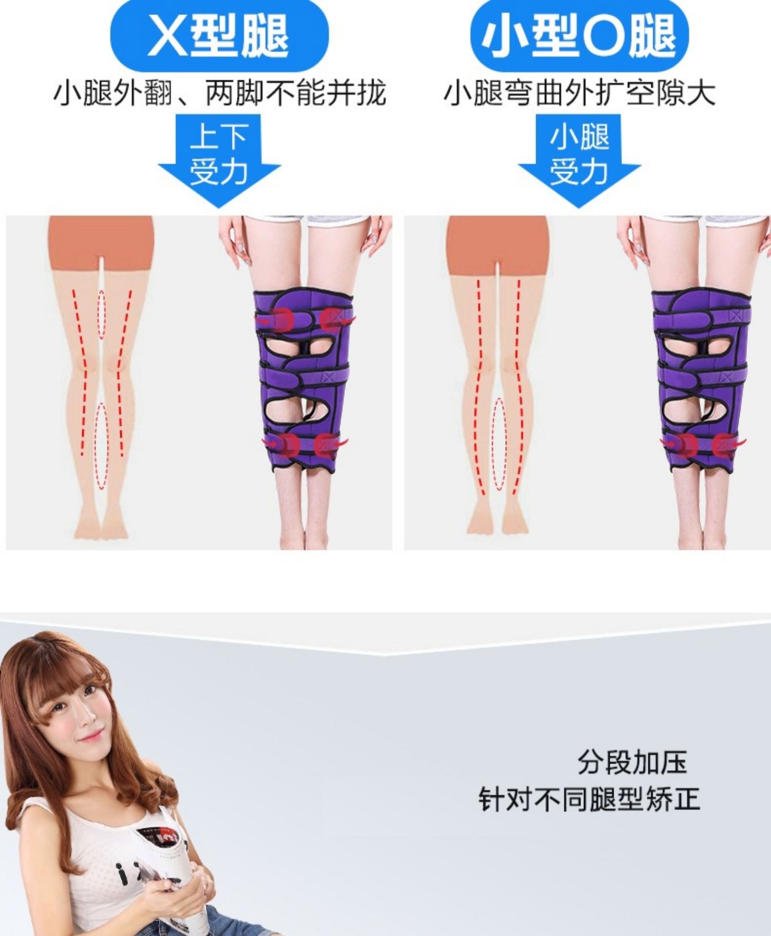 钦仰!罗圈腿矫正"怎么进行"-第1张图片-天福博客