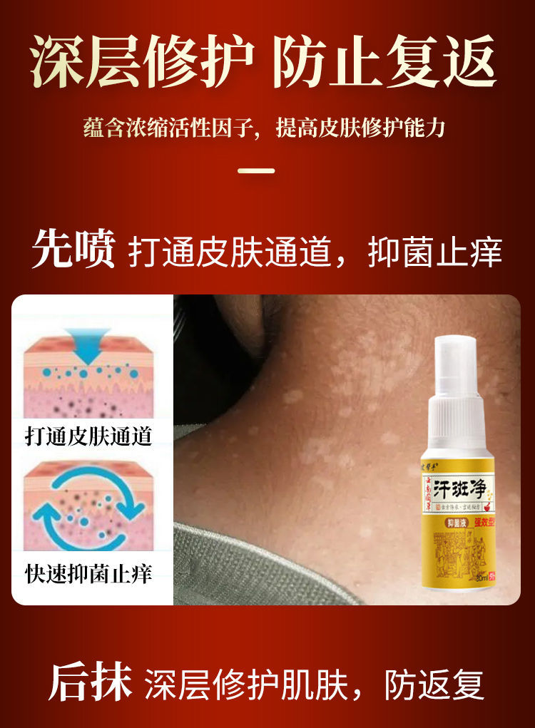 汗斑净汗斑专用去i花斑藓火斑白斑胸前背部片状药i膏喷剂 买2 1共发三