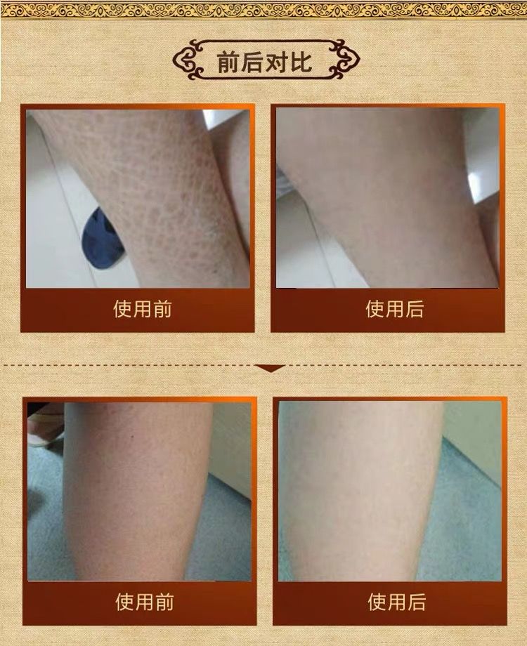 蛇皮肤跟鸡皮肤的区别(蛇皮肤跟鸡皮肤的区别在哪)