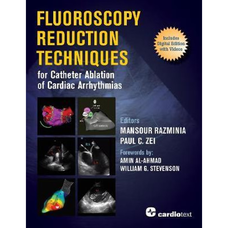 按需印刷Fluoroscopy Reduction Techniques for Catheter Ablation of Cardiac Arrhythmias[9781942909309]
