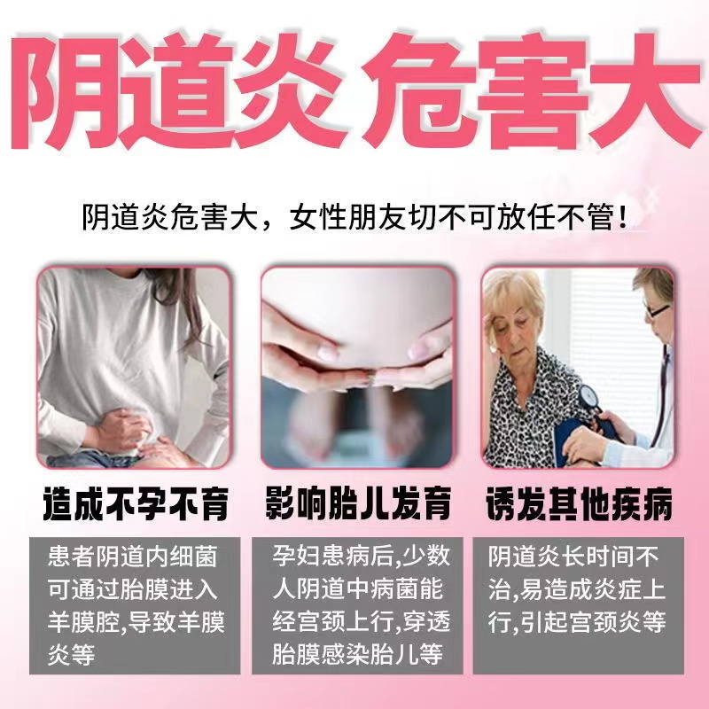 外阴瘙痒症妇科病图片