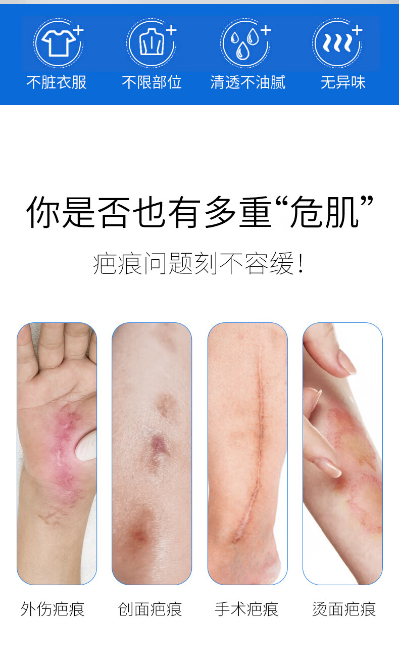 奇力康医用疤痕软膏术后疤痕愈合期烧伤烫伤创面护理辅助治疗改善软膏