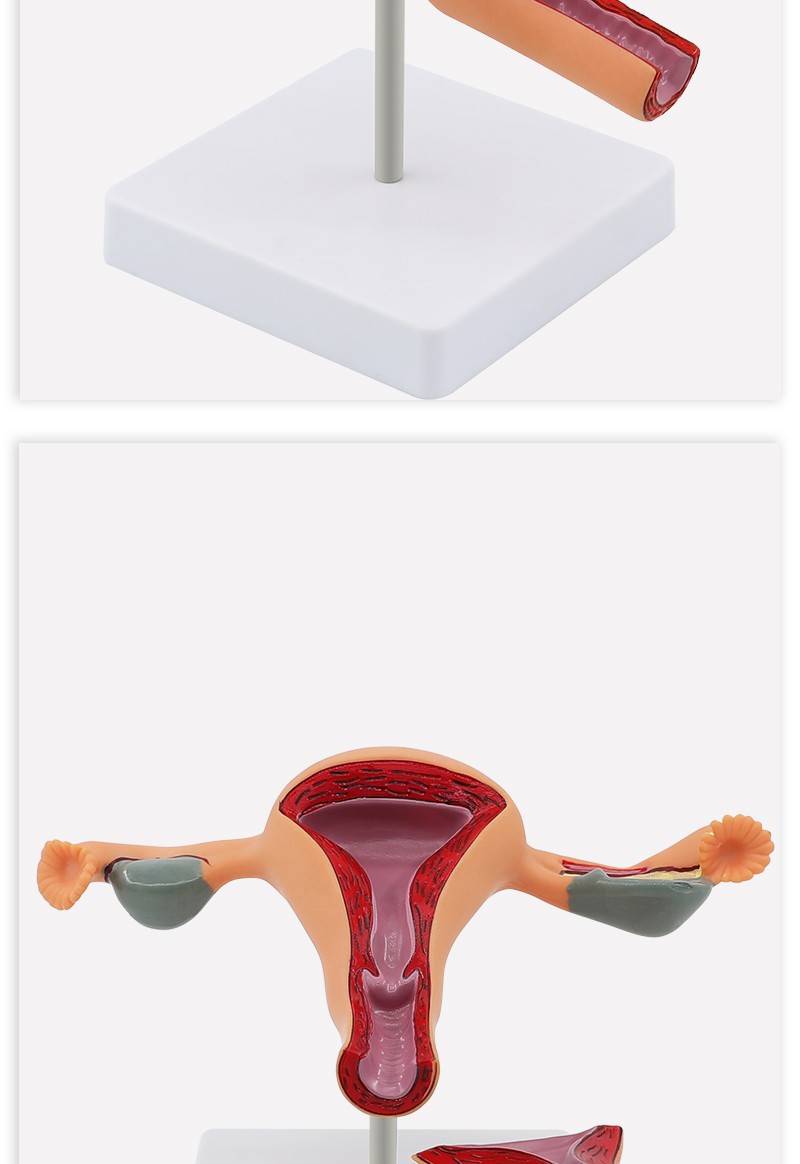 女性生殖子宫解剖模型卵巢教学模型人体妇生殖科教学用具 病理子宫