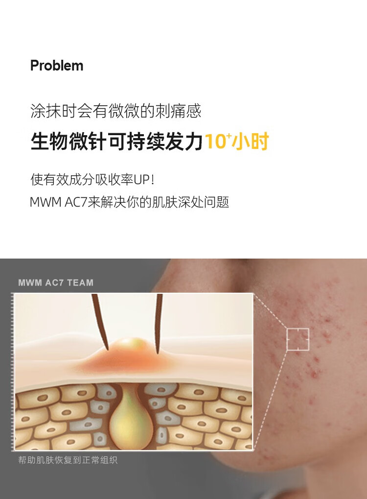 MWM祛痘膏AC7精华液闭口粉刺淡化痘印痘坑生物青少年学生痘印 一支15g