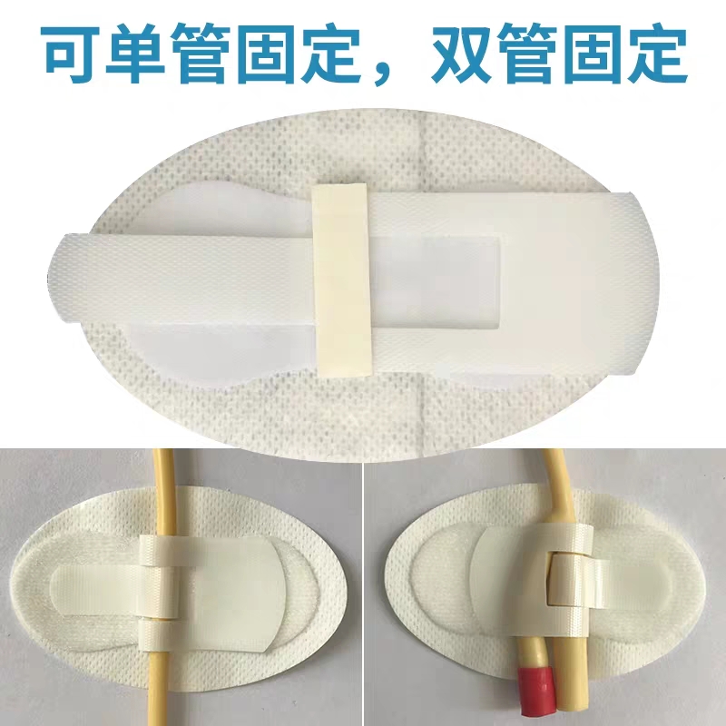 innomed隆泰导管固定敷料导管固定贴picc导尿管鼻饲鼻氧管固定贴隆泰
