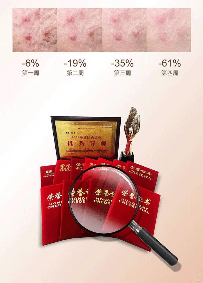 伟博优肤堂膏痘立净精华液紫草印痘坑青春痘闭口粉刺女男惊喜推荐款