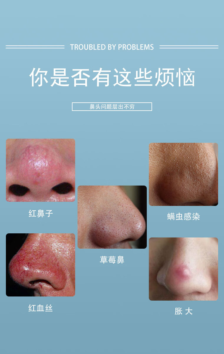 七方堂酒糟糠皮肤膏酒糟鼻红鼻子红血丝去黑头膏外用【图片 价格 品牌