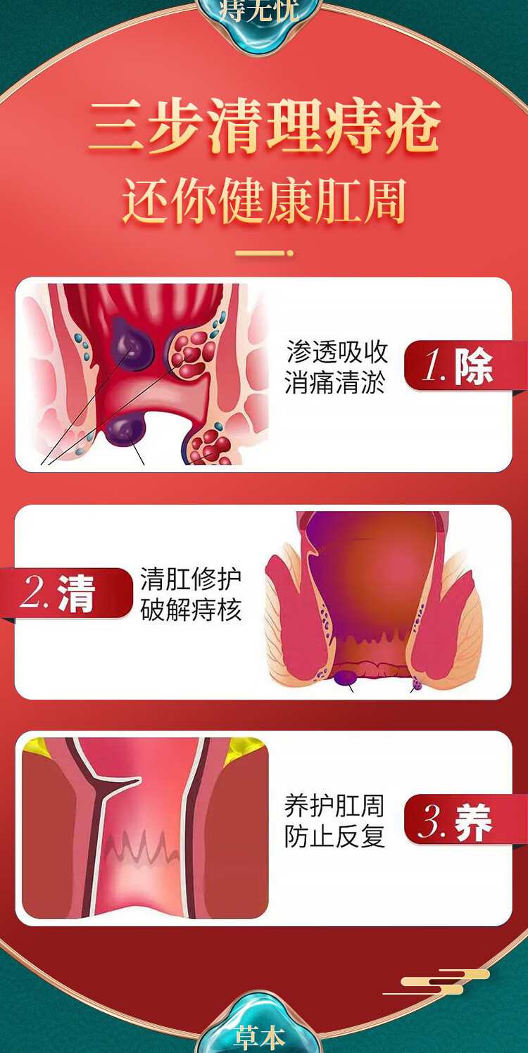 南京同仁堂痔瘡膏肉球去腚凝安凝膠消內外混合治肛門瘙癢便血脫肛裂肛