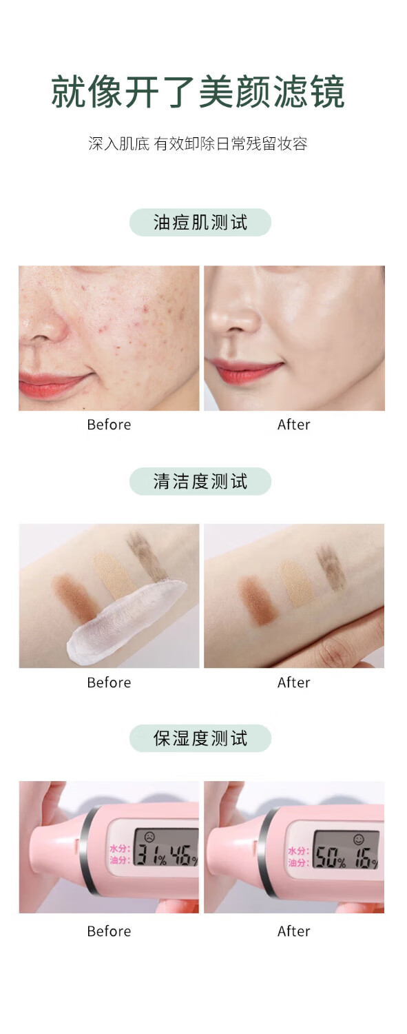 CINBI叶绿素氨基酸洗面奶清洁黑头毛孔油痘去角质亚马逊白泥洁面泥男女 氨基酸洗面奶 100g 【净颜透润】