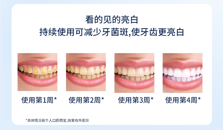 153bfe4472a9cbd1.png