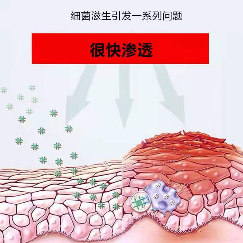 修正肤乐抑菌膏图片